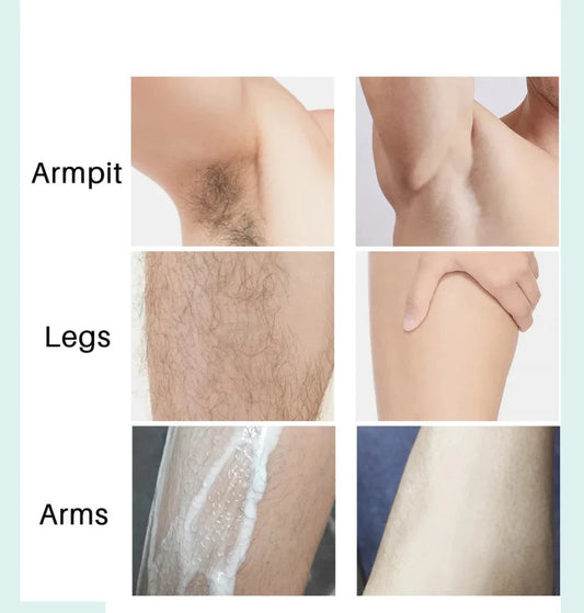 Ecrin Hair Removal Spray